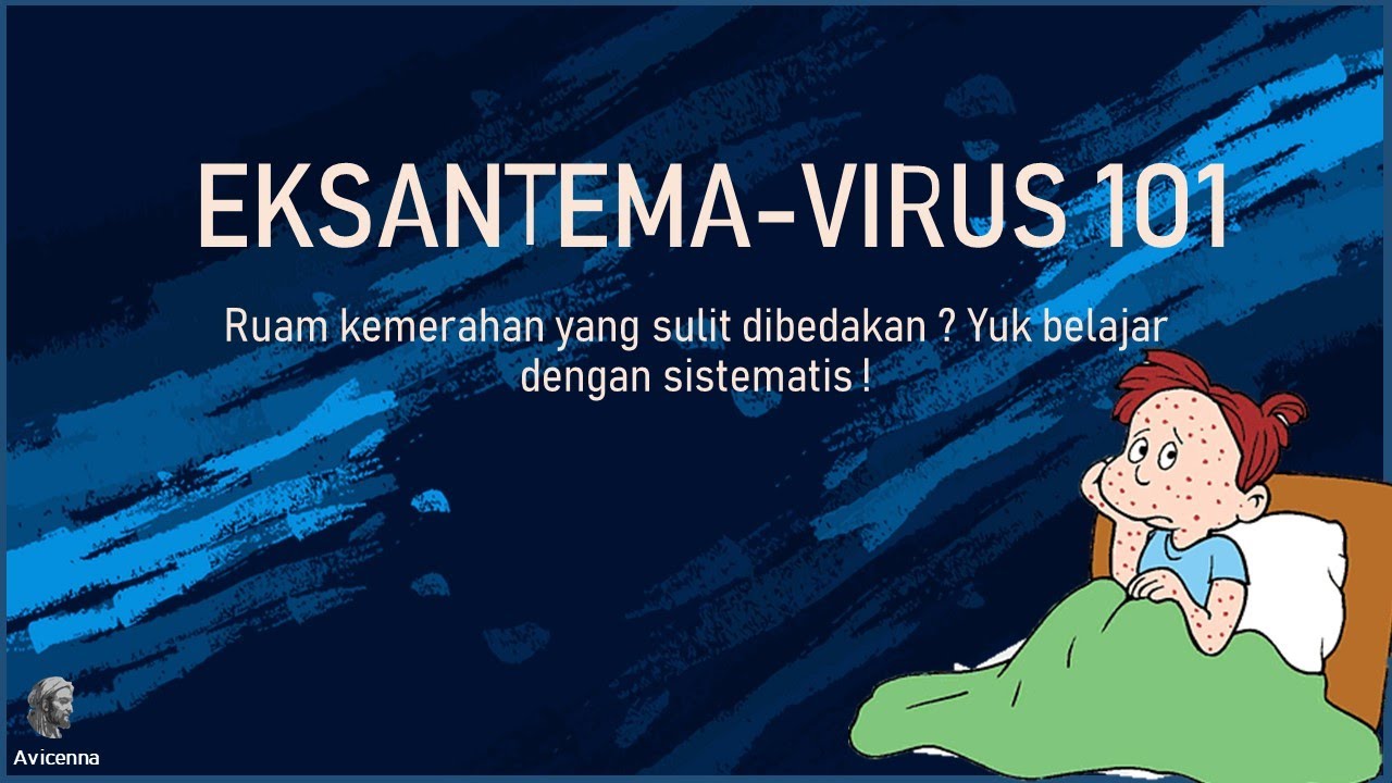 EKSANTEMA VIRUS : RUBEOLA, RUBELA, ROSEOLA INFANTUM. DUH SUKA KEBALIK-KEBALIK GAK SIH !