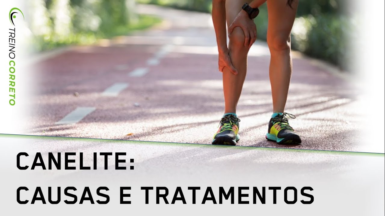 Canelite: Mitos e Verdades no Tratamento - Treino Correto #83