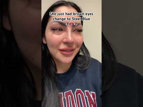 Results are immediate after ColorEyes procedure!