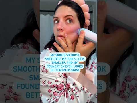 Just a few reasons we're using the Microderm Elite Pro🙌