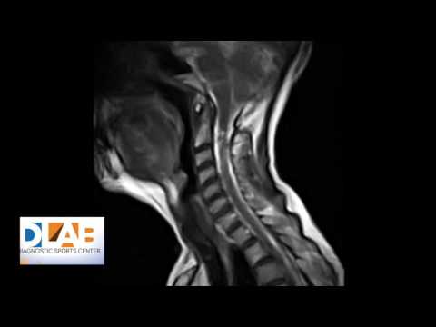Iniezioni di acido ialuronico nellarticolazione del ginocchio Kazan dove fare lecografia del ginocchio
