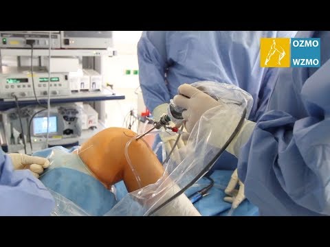 Prof. Dr. Diehl: Athroskopische Kreuzband Operation, minimalinvasiv im OZMO