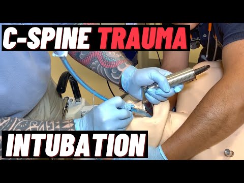 How to Intubate a Trauma Patient with Suspected Cervical Spine Injury? Video GlideScope MILS Bougie