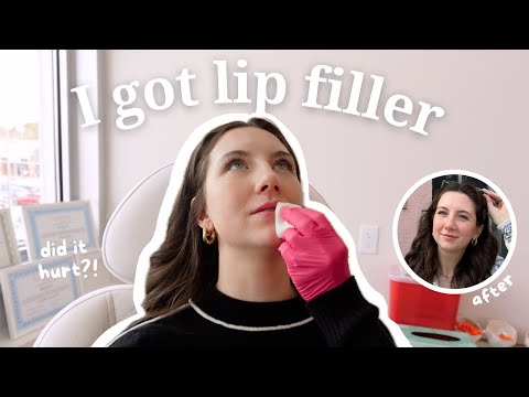 Come With Me To Get Lip Filler | vlog, pain scale, and before & after results