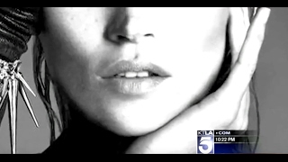 Dr. Garo Kassabian Lift Md Aesthetics: Liquid facelift with Voluma injection - KTLA