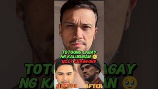 &quot;Totoong lagay ng kalusugan ni Billy Crawford 🥹&quot; #billycrawford #coleengarcia