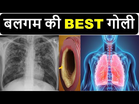 Acebrofon-sr capsules 200mg