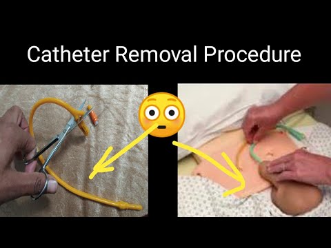 Suction Catheter ,8,10,12,14,16,18 Fr