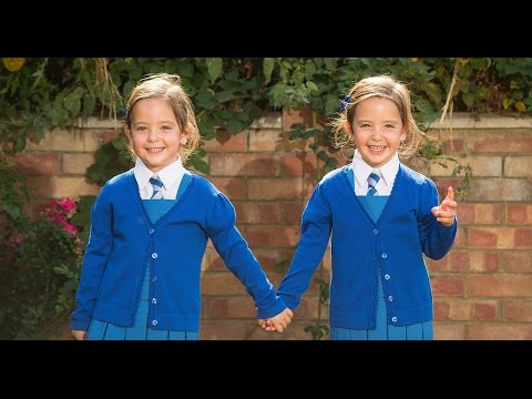 Click to Watch the 'They couldn't tell what was connecting them': Miraculous story of conjoined twins defeating the odds video