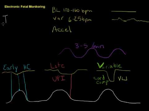Electronic Fetal Monitoring