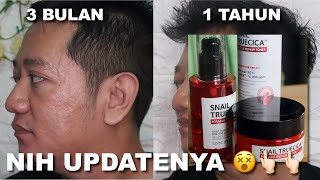 Download lagu PAKAI 1 TAHUN !! SNAIL TRUECICA MIRACLE REPAIR SERUM 😆 HASILNYA GINI BUAT BOPENG | Maria Soelisty mp3