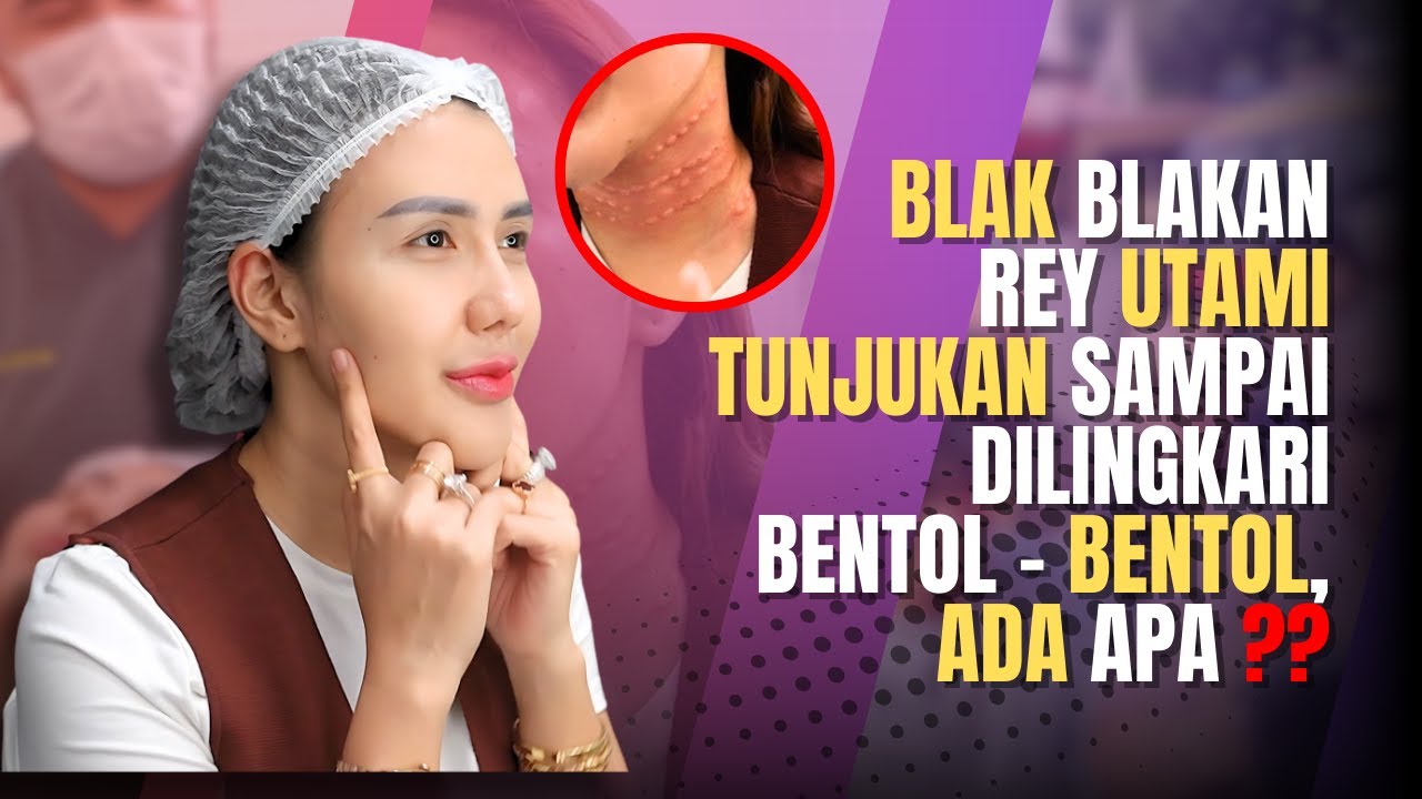 Sorotan Kecantikan Identik, Rey Utami Jajal Serangkaian Perawatan Kulit Premium