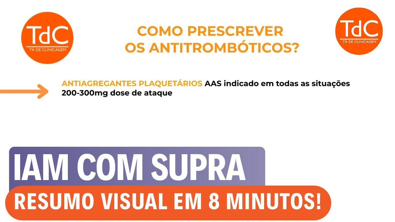 Infarto com supra do segmento ST - Resumo em 8 minutos