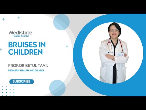 Bruises in Children | Medistate Hospital