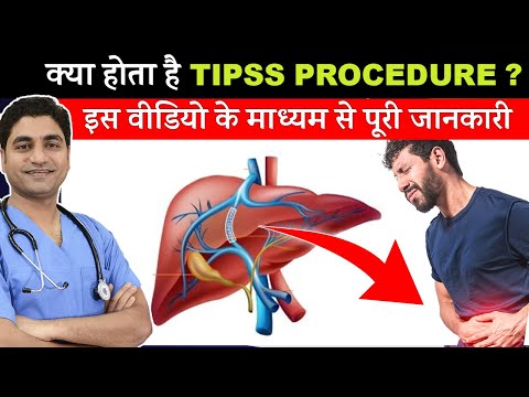 What is Transjugular Intrahepatic Portosystemic Shunt (TIPS) Procedure & Used Cases?