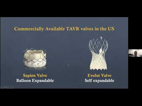 New Frontiers in Structural Heart Disease