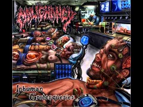 Malignancy   Inhuman Grotesqueries title track