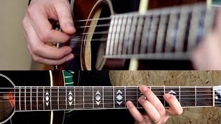 Masterpieces (I Can’t Sing) | René And Georgette Magritte With Their Dog After The War