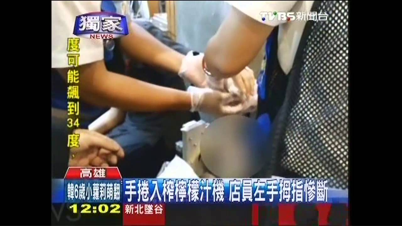 〈獨家〉手捲入榨檸檬汁機　店員左手拇指慘斷