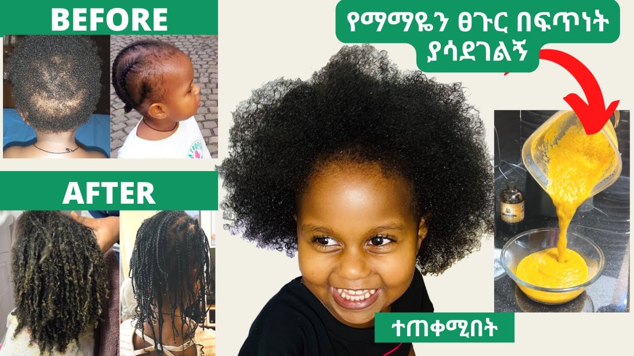 How to grow your kids hair fast FetanZena