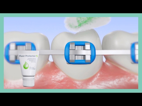 Fluor Protector S - Application Instructions