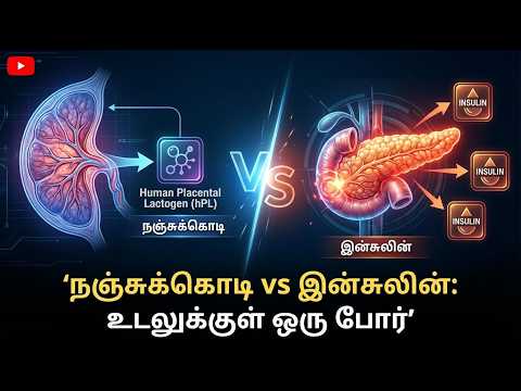 Understanding GDM — video thumbnail