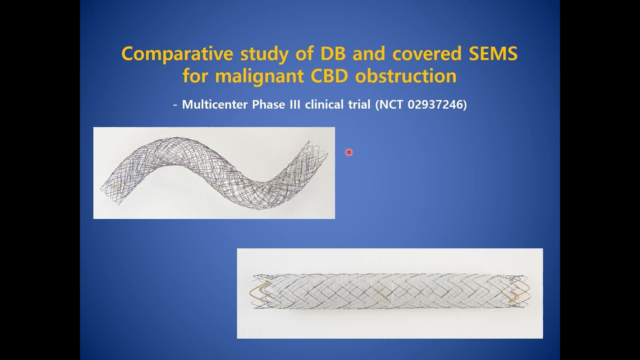 Double layered metal stent for malignant bile duct obstruction - Seungmin Bang