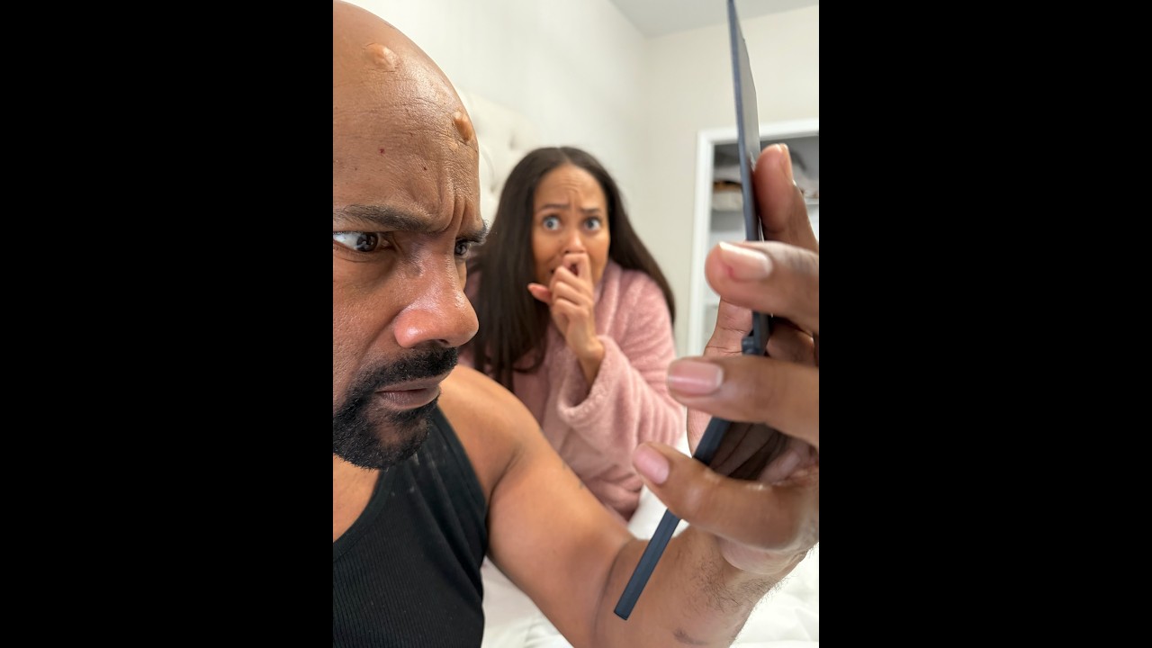 When Malachi wakes up covered in hives!