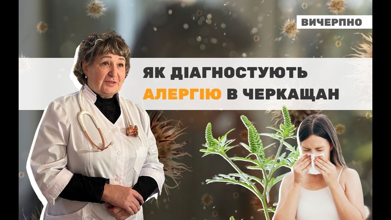 Кожен четвертий потребував лікування в стаціонарі: як діагностують алергію в Черкаській обллікарні