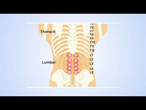 How DRG stimulation at T12 reveals the transmission of low back pain in the spinal cord: The theory
