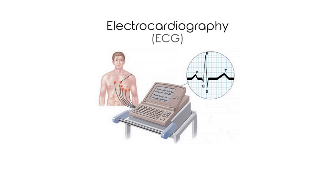 ECG digitization Video