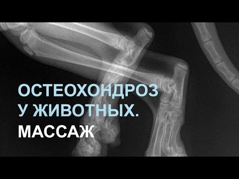 Отек после операции на локтевом суставе Упражнения в картинках для шейного остеохондроза