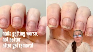 Nails getting worse instead of better when doing everythig right?