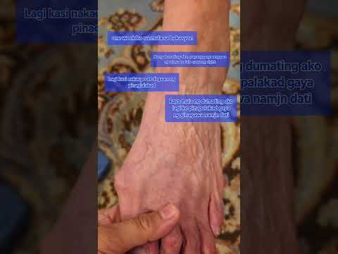 Mukhang pinabayaan #israelcaregiver @baebssilva