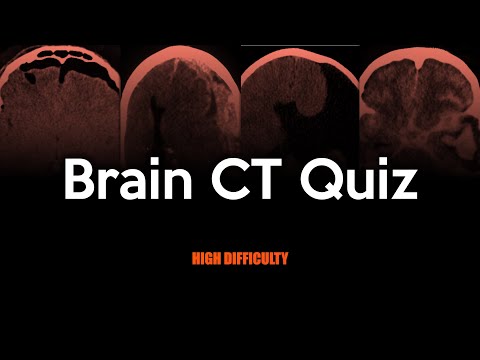 Brain CT Quiz: High Difficulty