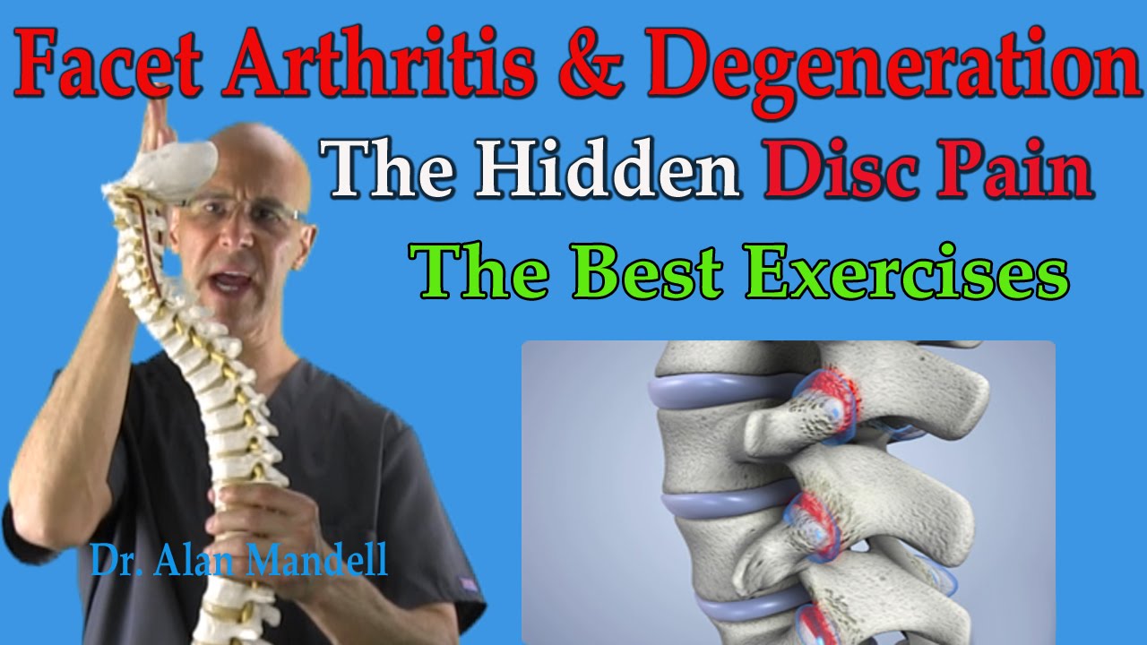 Facet Arthritis & Degeneration (The Hidden Disc Pain) Best Exercises - Dr Mandell - YouTube