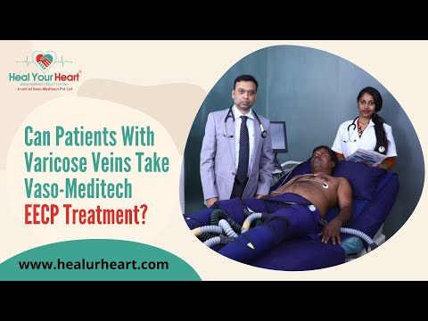Is EECP Treatment Possible for Varicose Veins Patients?
