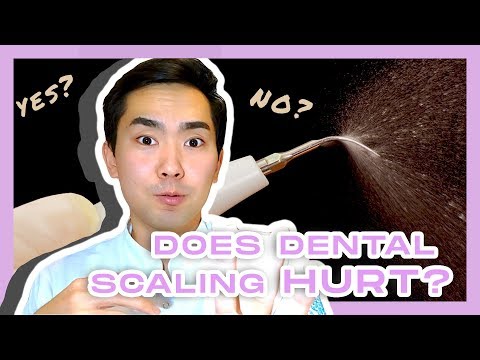 YouTube video about: Can teeth cleaning damage teeth?