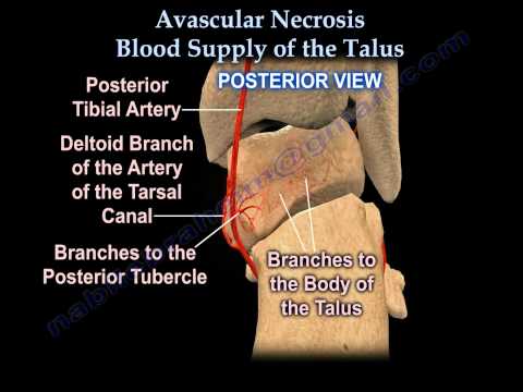 Talus fracture ,Avascular Necrosis, Blood Supply  - Everything You Need To Know - Dr. Nabil Ebraheim