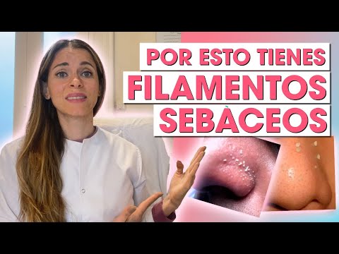 Filamentos sebáceos, nunca más