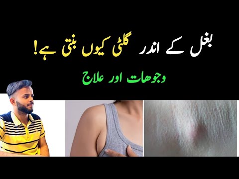 Armpit Fat or Armpit Lump in Urdu/Hindi | Bagal mein gilti ka hona | How to Get rid of armpit Fat