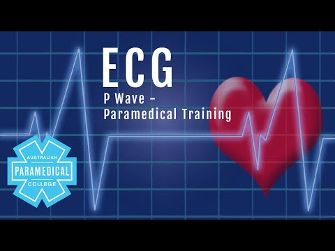 ECG Basics #3 P Wave - Australian Paramedical College