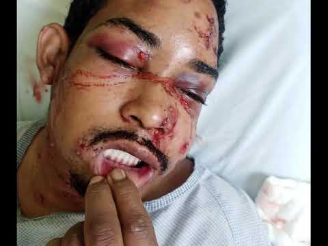 Police Called for Disturbance Man in Hospital with Serious Injuries