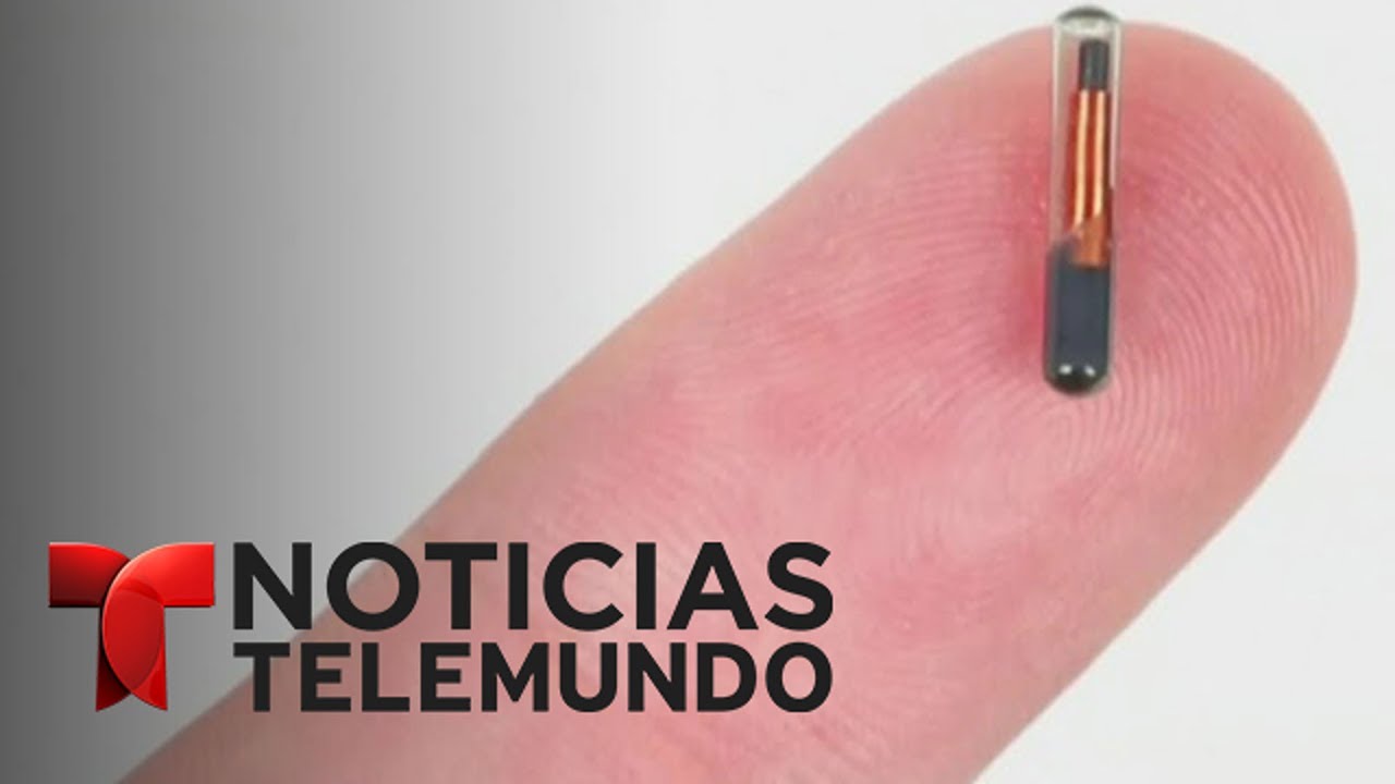 Implantan microchips a empleados de una empresa en Wisconsin | Noticiero | Noticias Telemundo