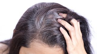 White Hair to Black Permanently in 7 Days with Potato Peel | Magical Remedy for Grey / White Hair