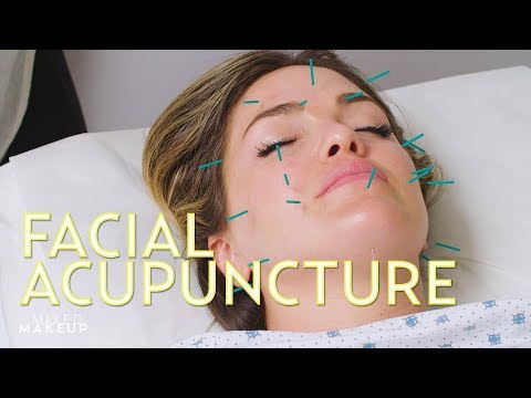Is Facial Acupuncture a Botox Alternative? We Found Out! | The SASS with Susan and Sharzad Video