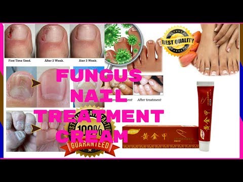 Tainga halamang-singaw lunas Paa halamang-singaw paggamot paghahanda review
