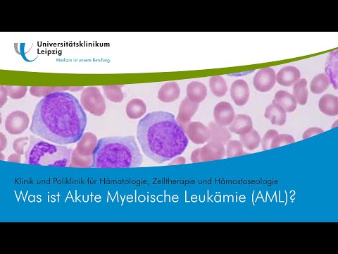 Was ist Akute Myeloische Leukämie (AML)?