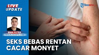 Warning Cacar Monyet, Dinkes Jakarta Sebut Hubungan Seksual Berisiko Bisa Menambah Penularan