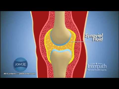 Subluxation des Schultergelenks Physiotherapie Last bei Gelenkerkrankungen